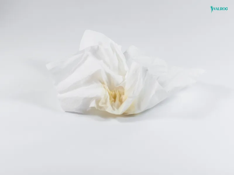 What Does Clear Mucus Mean Color Guide